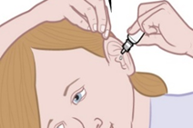 Image representing Blocked Ear (wax)